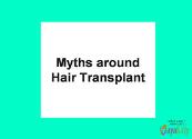 Myths Around Hair Transplant Powerpoint Presentation