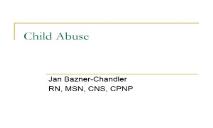 Child Abuse PowerPoint Presentation