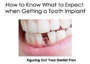How to Know What to Expect when Getting a Tooth Implant Powerpoint Presentation