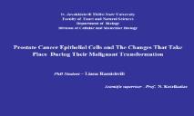 Prostate cancer epithelial cells and the changes that take place PowerPoint Presentation