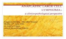 Anaplastic Large Cell Lymphoma PowerPoint Presentation