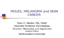 Moles and Melanoma PowerPoint Presentation