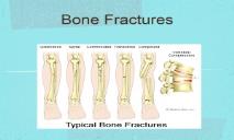 Bone Fractures-Wikispaces PowerPoint Presentation