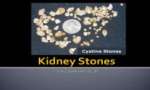 Kidney Stone PowerPoint Presentation