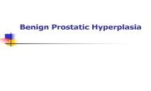 Benign Prostatic Hyperplasia Overview PowerPoint Presentation