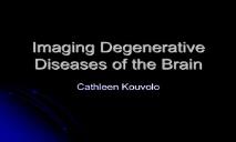 Imaging Degenerative Diseases of the Brain PowerPoint Presentation