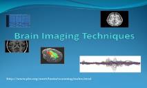Brain Imaging Techniques PowerPoint Presentation