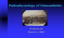 Pathophysiology of Osteoarthritis PowerPoint Presentation