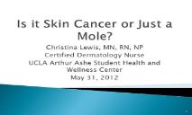 Is it Skin Cancer or Just a Mole PowerPoint Presentation