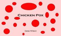 Chicken Pox Info PowerPoint Presentation