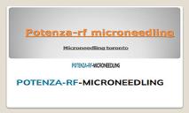 Microneedling platelet rich plasma PowerPoint Presentation