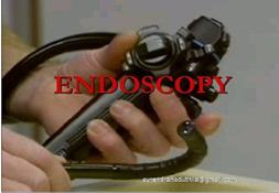 Endoscopy Powerpoint Presentation