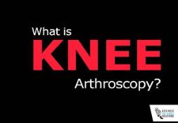 What is Knee Arthroscopy? PowerPoint Presentation