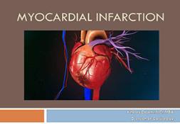 Myocardial Infarction PowerPoint Presentation