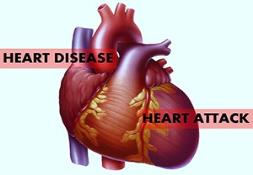 Heart Disease and Heart Attack Powerpoint Presentation