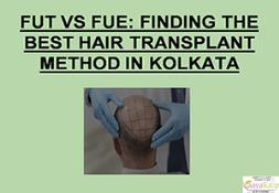 FUT VS FUE-FINDING THE BEST HAIR TRANSPLANT METHOD IN KOLKATA Powerpoint Presentation