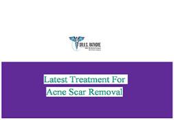 Latest Treatment For Acne Scar Removal PowerPoint Presentation