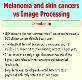 Skin cancer and melanoma Powerpoint Presentation