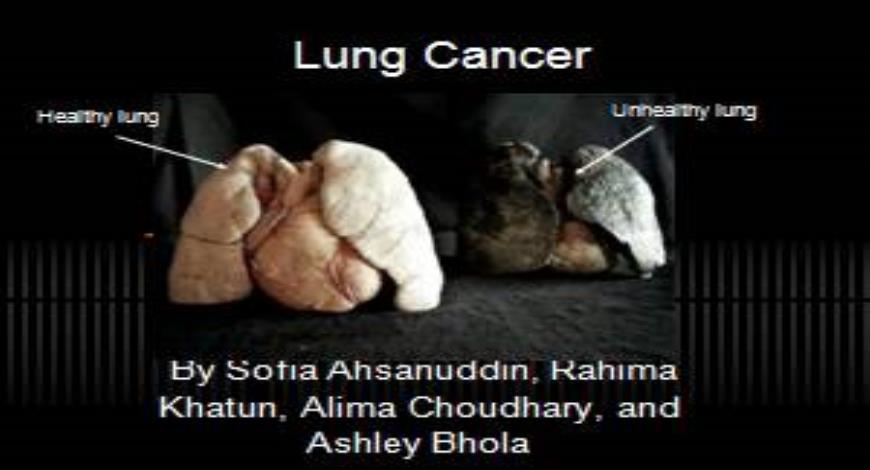 free-download-lung-cancer-powerpoint-presentation-slides